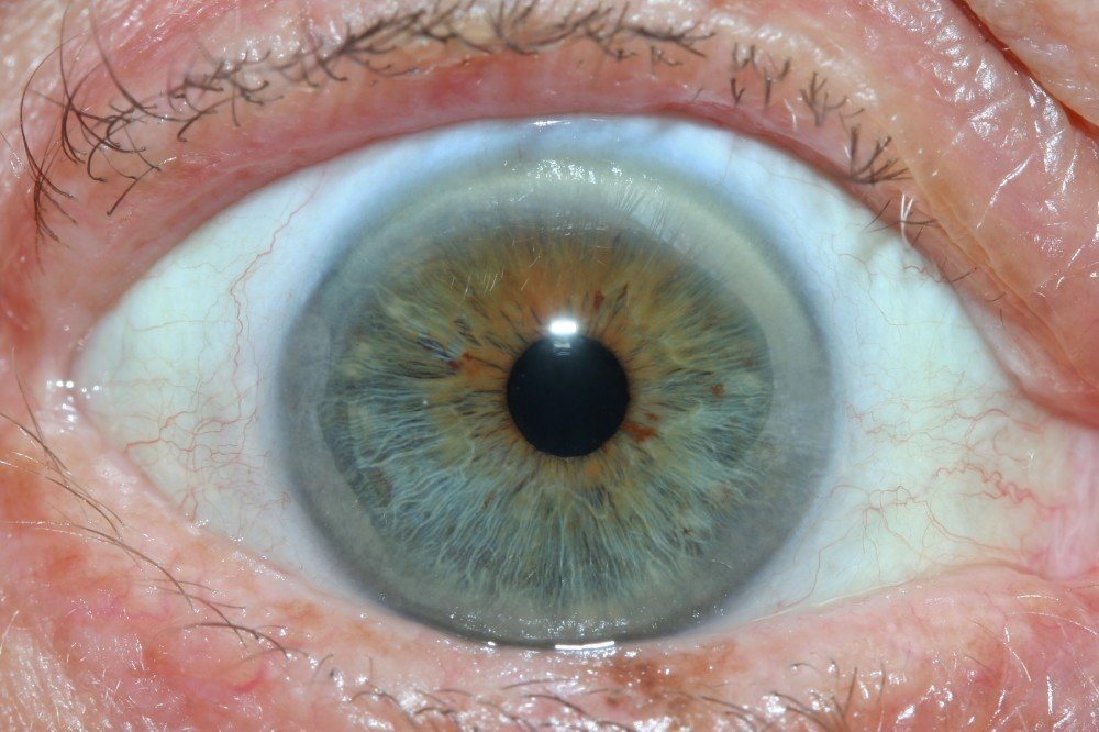 MAIKONG IRIDOLOGY CAMERA 2512