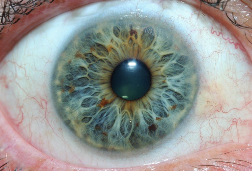MAIKONG IRIDOLOGY CAMERA 2513