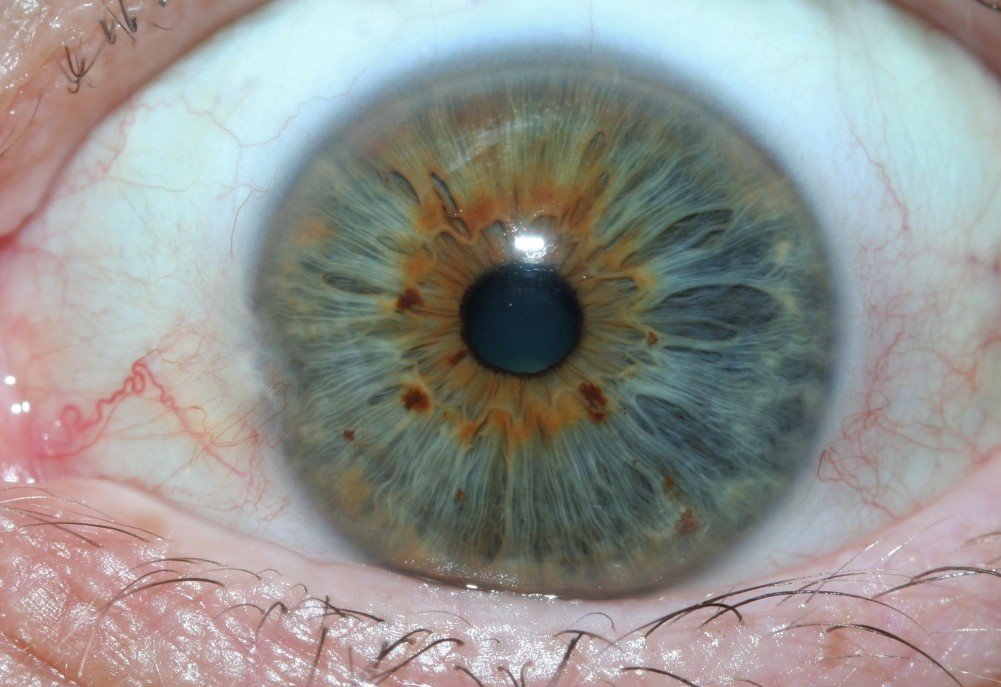 MAIKONG IRIDOLOGY CAMERA 2522