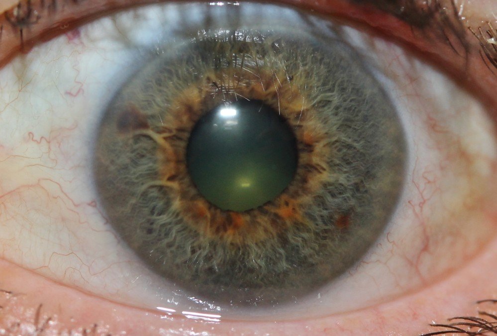 MAIKONG IRIDOLOGY CAMERA 2531