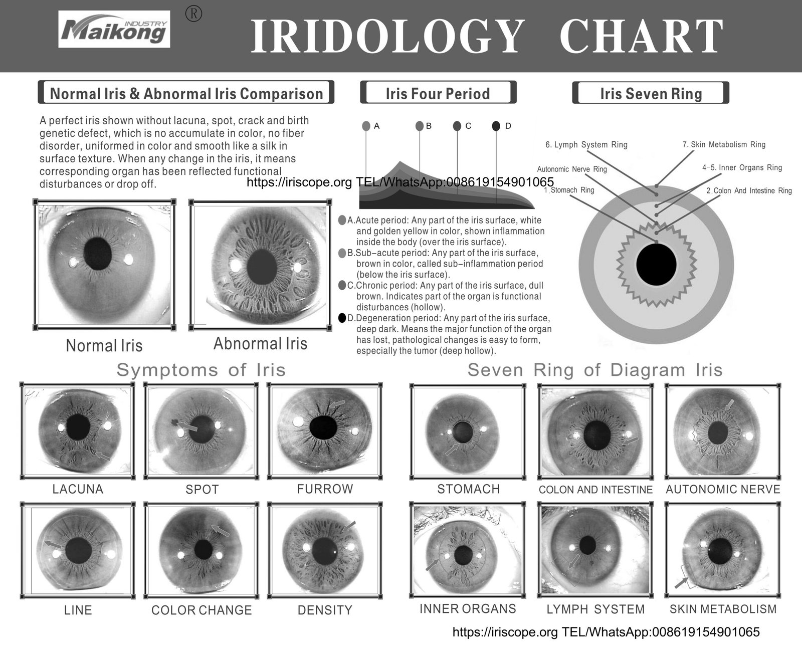 Iridologiekaart