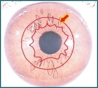 Illustratie van Iridologie – 3.4 Interne Organen