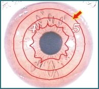 Illustration of Iridology 3.4 Internal Organ 002