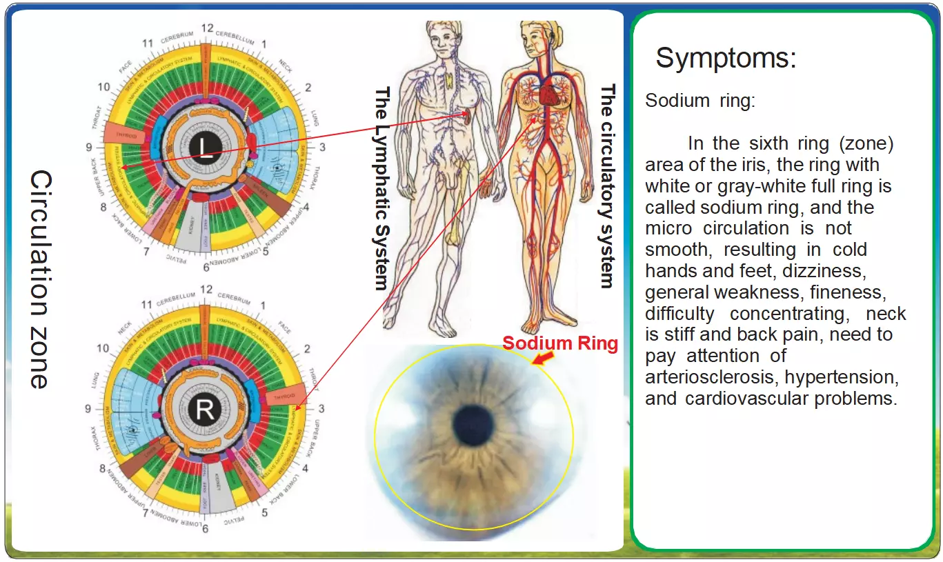 Iridologie en de Natriumring: Een Diepgaande Analyse van de Bloedsomloopzone Het Lymfestelsel en Cardiovasculair Systeem in de Irisdiagnostiek